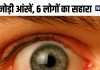 एक जोड़ी आंखें दे रहीं 6 लोगों को रोशनी, आरपी सेंटर AIIMS में हो रहा कमाल, पढ़ें कैसे