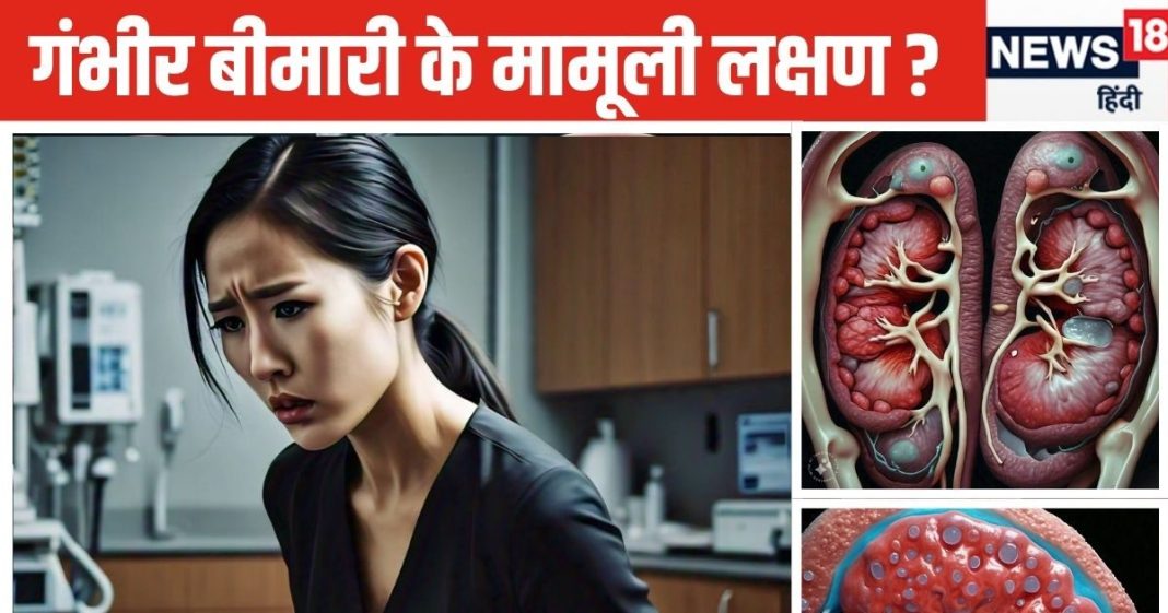 कहीं हल्के में तो नहीं ले रहे पीठ और सिर दर्द? पॉलीसिस्टिक किडनी डिजीज के हो सकते लक्षण, इन उपायों से मिलेगी राहत!