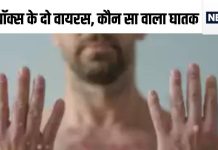 दिल्ली के अस्पताल में मंकीपॉक्स का मरीज लेकिन घबराने से पहले जान लें कितना खतरनाक है वायरस