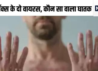 рджрд┐рд▓реНтАНрд▓реА рдХреЗ рдЕрд╕реНтАНрдкрддрд╛рд▓ рдореЗрдВ рдордВрдХреАрдкреЙрдХреНтАНрд╕ рдХрд╛ рдорд░реАрдЬ рд▓реЗрдХрд┐рди рдШрдмрд░рд╛рдиреЗ рд╕реЗ рдкрд╣рд▓реЗ рдЬрд╛рди рд▓реЗрдВ рдХрд┐рддрдирд╛ рдЦрддрд░рдирд╛рдХ рд╣реИ рд╡рд╛рдпрд░рд╕