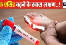 यूरिक एसिड बढ़ने का संकेत देते हैं शरीर के ये अंग, इनसे उठने वाला दर्द कर देता है बेहाल, यहां जानें इसकी वजह