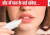 फटे होंठ को हल्के में न लें, ये कई बीमारियों की ओर है इशारा,नाखूनों की कमजोरी में भी गहरा संकेत
