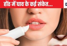 फटे होंठ को हल्के में न लें, ये कई बीमारियों की ओर है इशारा,नाखूनों की कमजोरी में भी गहरा संकेत