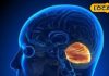 कैंसर रोग विशेषज्ञ से जानिए ब्रेन कैंसर के लक्षण और उपचार