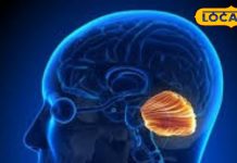 कैंसर रोग विशेषज्ञ से जानिए ब्रेन कैंसर के लक्षण और उपचार