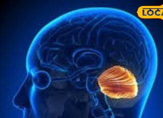 कैंसर रोग विशेषज्ञ से जानिए ब्रेन कैंसर के लक्षण और उपचार