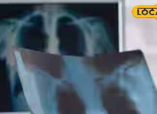 अब 1 रुपए में होगा अल्ट्रासाउंड, इन मरीजों को मिलेगी सुविधा