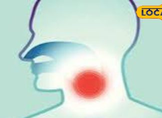 गले और मुंह के कैंसर के ये हैं लक्षण, जानें कैंसर रोग विशेषज्ञ से हर डिटेल