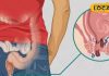 Piles Treatment: क्षार सूत्र से खत्म होगी बवासीर बीमारी, जानें लक्षण-कारण और इलाज