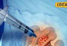 Biopsy Test: क्या बायोप्सी टेस्ट से फैलता है कैंसर? एक्सपर्ट डॉक्टर से जानें सच