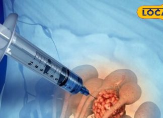 Biopsy Test: क्या बायोप्सी टेस्ट से फैलता है कैंसर? एक्सपर्ट डॉक्टर से जानें सच