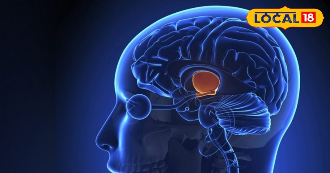 Health Tips : युवा क्यों हो रहे हैं ब्रेन स्ट्रोक के शिकार? क्या है इससे बचने का उपाय? डॉक्टर से जानिए सब