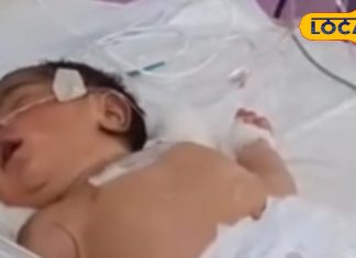 बच्चों के लिए खतरनाक है ये बदलता मौसम, औरंगाबाद के शिशु चिकित्सक ने दी काम की सलाह