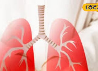 Cancer: ये लक्षण दिखें तो हो जाएं सावधान, लंग कैंसर की हो सकती है शुरुआत, जानें एक्सपर्ट की राय