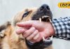 Dog Bite remedy: कुत्ते के काटने पर तुरंत करें ये काम, वरना हो सकता है बड़ा नुकसान, जानें एक्सपर्ट की राय