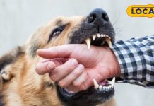 Dog Bite remedy: कुत्ते के काटने पर तुरंत करें ये काम, वरना हो सकता है बड़ा नुकसान, जानें एक्सपर्ट की राय