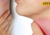 Health Tips: पहाड़ में बढ़ रहे गले की एलर्जी के मरीज, डॉक्टर से जानिए इसका कारण और इलाज