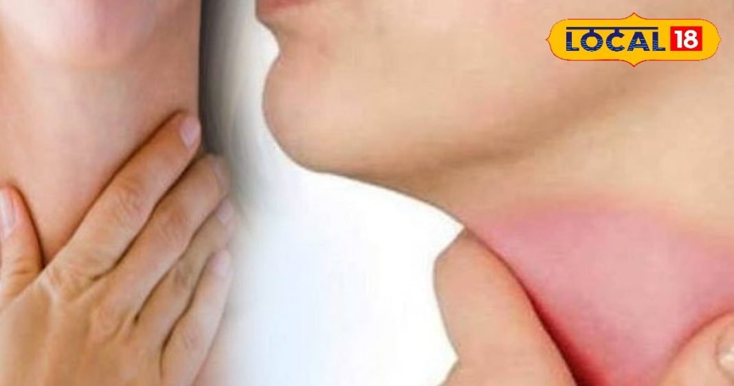 Health Tips: पहाड़ में बढ़ रहे गले की एलर्जी के मरीज, डॉक्टर से जानिए इसका कारण और इलाज