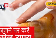 Diwali 2024: दिवाली के दिन पटाखों से जल जाए शरीर, तो ऐसे ठीक करें घाव, भूलकर भी न लगाएं ये चीजें