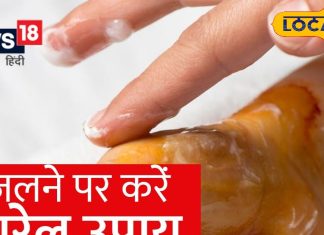 Diwali 2024: दिवाली के दिन पटाखों से जल जाए शरीर, तो ऐसे ठीक करें घाव, भूलकर भी न लगाएं ये चीजें