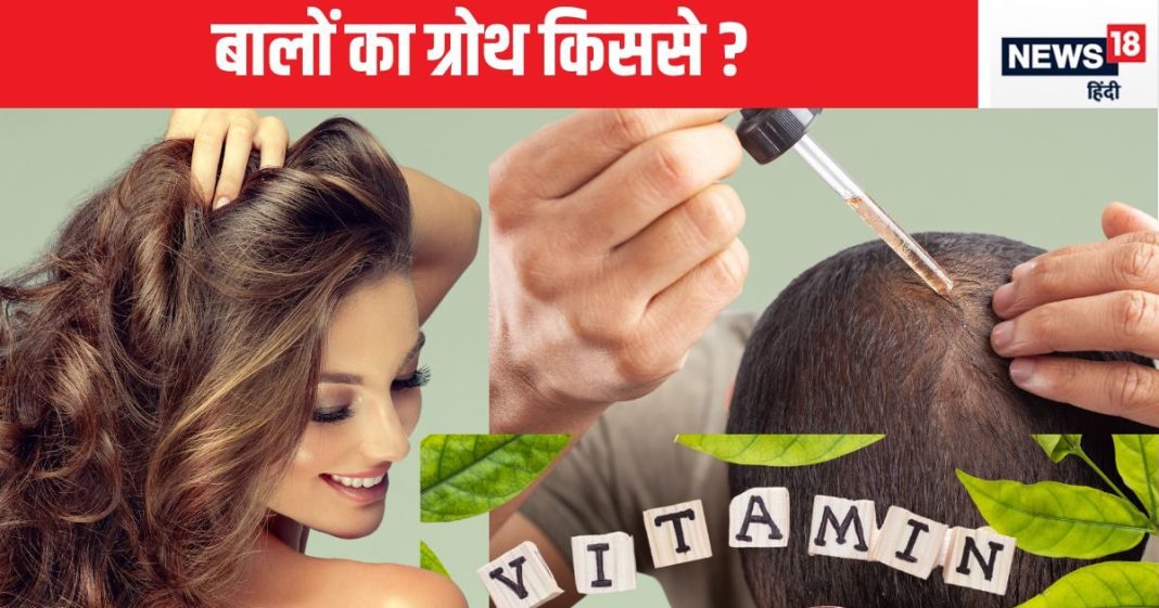 बालों का ग्रोथ किससे होगा-विटामिन सप्लीमेंट से या मिनोक्सीडिल दवा से, स्किन के डॉक्टर से जान लीजिए सच्चाई, हर चीज का पता चलेगा
