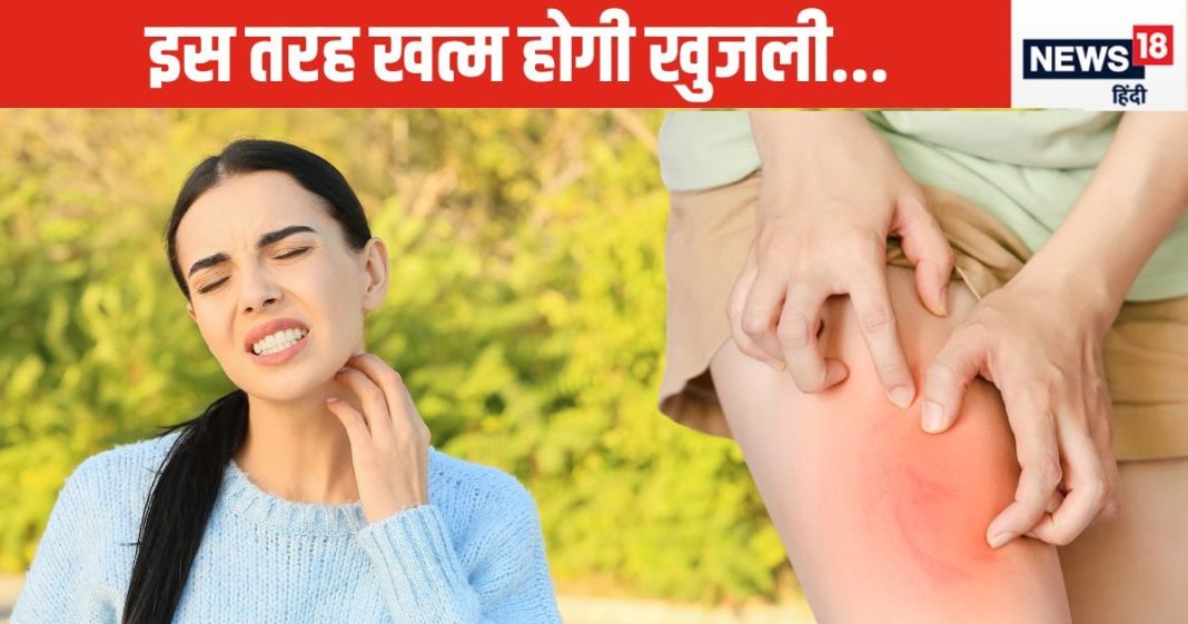खुजली के लिए इतना परेशान होने की जरूर नहीं, मामूली सी चीजें भी बन सकती है रामबाण, घर में ही सब मौजूद