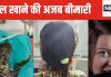16 साल से अपने सिर के बाल नोच कर खाती थी युवती, दुर्लभ बीमारी ट्राईकोटिलोमेनिया से थी ग्रस्त, जानें लक्षण कारण, इलाज