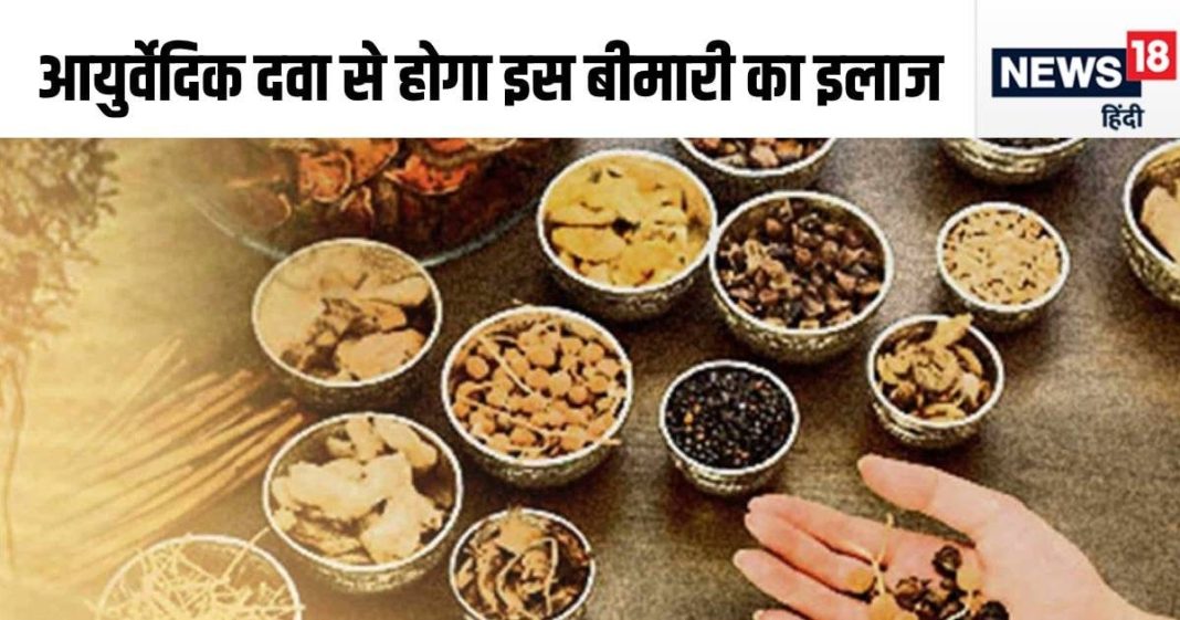इस दर्द भरी खतरनाक बीमारी का इलाज करेगा आयुर्वेद, दवा पर शुरू हुआ रिसर्च