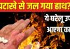Diwali Safety Tips: दीये-पटाखों से जल गई उंगली? तुरंत करें ये घरेलू उपाय, जलन से मिलेगी राहत