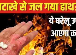 Diwali Safety Tips: दीये-पटाखों से जल गई उंगली? तुरंत करें ये घरेलू उपाय, जलन से मिलेगी राहत