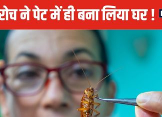 पेट दर्द से परेशान था शख्स, डॉक्टर्स ने की जांच, तो आंत में दौड़ रहा था कॉकरोच ! जानें हैरान करने वाला मामला