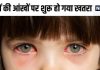 20 दिन तक बच्चों की आंखों पर रहेगा खतरा, हो सकता है अंधापन, एम्स डॉ. ने दी पेरेंट्स को जरूरी सलाह