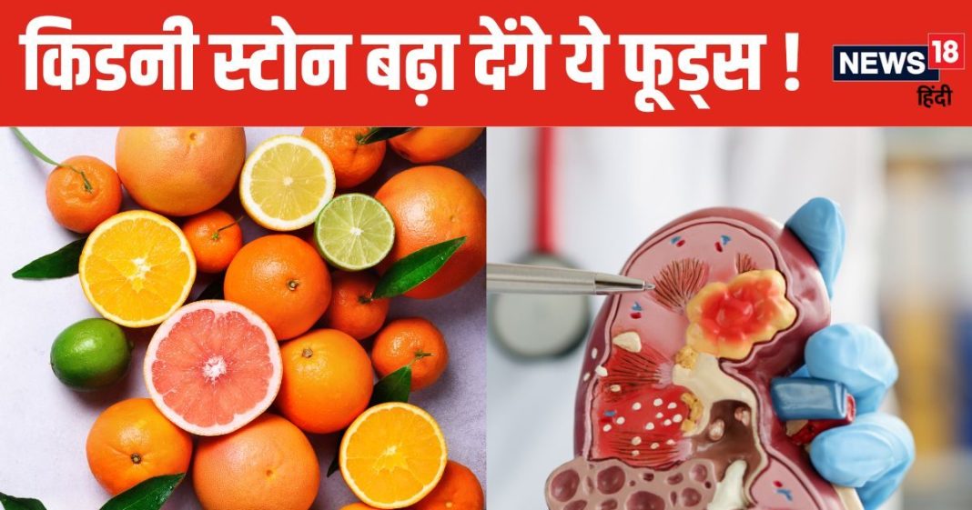 किडनी स्टोन के मरीज भूलकर भी ज्यादा न खाएं 5 फूड्स, वरना बढ़ेगा पथरी का साइज, वक्त रहते हो जाएं अलर्ट
