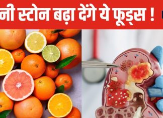 किडनी स्टोन के मरीज भूलकर भी ज्यादा न खाएं 5 फूड्स, वरना बढ़ेगा पथरी का साइज, वक्त रहते हो जाएं अलर्ट