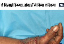 कलाई से कटकर अलग गिरा हाथ, खुद ही अस्पताल लेकर पहुंचा मरीज, फिर जो हुआ….