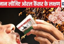 ओरल कैंसर के सबसे ज्यादा मामले भारत में, लेंसेट की नई रिपोर्ट से सनसनी, ये है इसके लक्षण और बचाव का तरीका