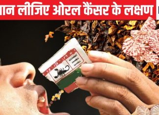 ओरल कैंसर के सबसे ज्यादा मामले भारत में, लेंसेट की नई रिपोर्ट से सनसनी, ये है इसके लक्षण और बचाव का तरीका