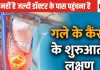 ये 6 संकेत दिखे तो समझिए गले में कैंसर के शुरुआत हो चुकी, देर हो इससे पहले डॉक्टर के पास जाएं, समय पर हो जाएगा इलाज