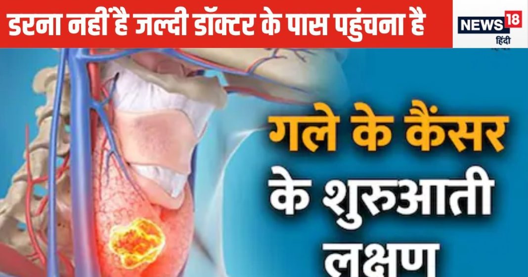 throat-cancer-sign-symptoms-and-treatment-2024-10-2d463007c96c5532bf4f89d0425f0bc4-16x9.jpg