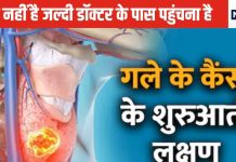 ये 6 संकेत दिखे तो समझिए गले में कैंसर के शुरुआत हो चुकी, देर हो इससे पहले डॉक्टर के पास जाएं, समय पर हो जाएगा इलाज