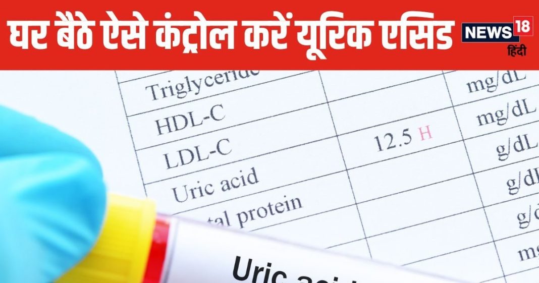 नॉर्मल से ज्यादा हो गया है यूरिक एसिड? टेंशन लेने के बजाय करें ये 5 काम, डाउन होने लगेगा मीटर !