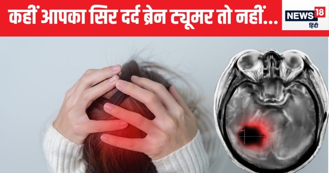 कहीं आपका सिर दर्द ब्रेन ट्यूमर के कारण तो नहीं, खुद ही पता कर लीजिए क्या है यह, सिंपल है तरीका