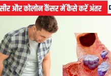 बवासीर कहीं कैंसर तो नहीं, लंदन के सर्जन ने बताया अंतर करने का सिंपल ट्रिक, टॉयलेट में जाकर ही हो जाएगी पहचान