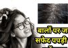 स्कैल्प पर जमे डैंड्रफ को साफ करने के लिए बेस्ट हैं ये 5 तेल, रोज करेंगे चंपी तो बाल होंगे जड़ से मजबूत