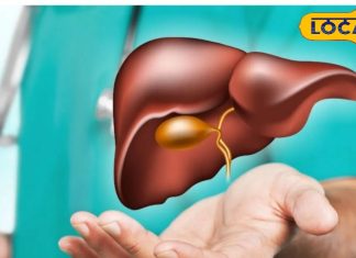Fatty Liver: इस खतरनाक बीमारी से बचकर रहें, भूलकर भी न करें ये काम, नहीं तो हेल्थ की बज जाएगी बैंड!