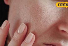 ठंड में खिंचती है त्वचा? विशेषज्ञ बता रहीं ट्रिक, जानें मॉइश्चराइजर और घरेलू उपायों का सही उपयोग…