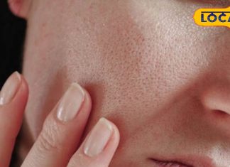 ठंड में खिंचती है त्वचा? विशेषज्ञ बता रहीं ट्रिक, जानें मॉइश्चराइजर और घरेलू उपायों का सही उपयोग…