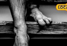 इस बीमारी से हर साल 8 लाख लोग खोते हैं जान! बचना है तो जान लें डॉक्टर की सलाह