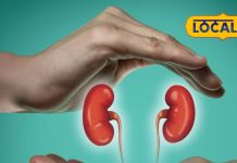 natural home remedies for kidney stone treatment and prevention sa