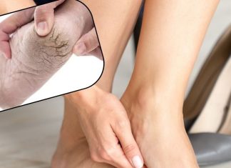 किस लिए फट जाती हैं पैरों की एड़ियां? इन सिंपल तरीकों से हो जाएंगी बेहद ही सॉफ्ट